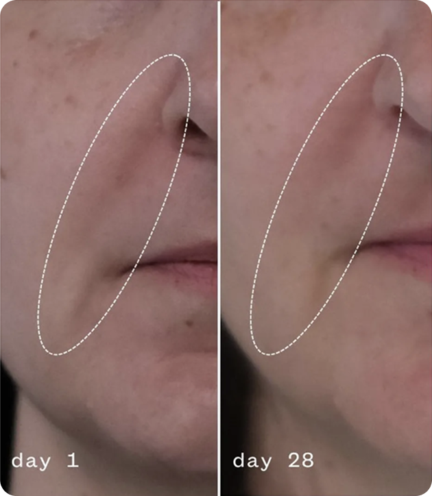 Anti-Aging Moisturizing Cream