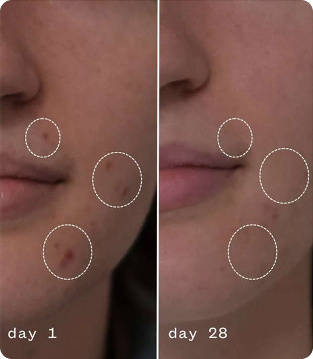 Anti-Aging Moisturizing Cream