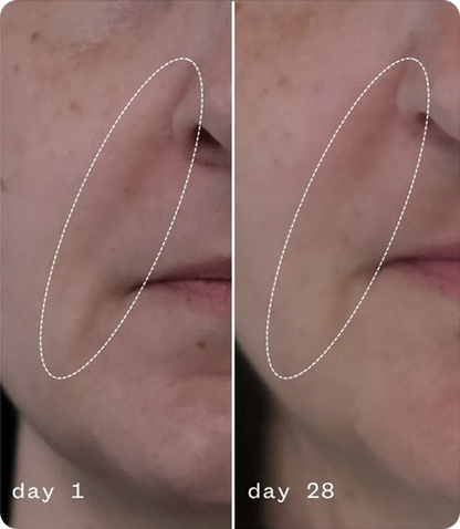 Anti-Aging Moisturizing Cream